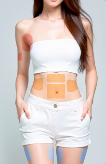 지방 집중 부위 모델