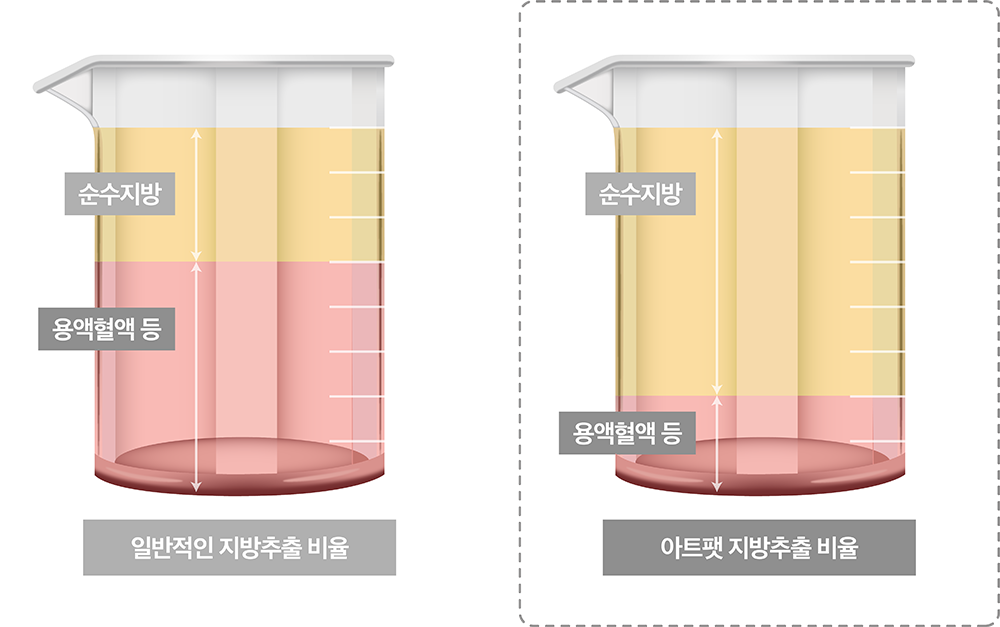 시술 전후 비교 1